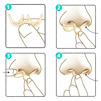 Clip nasal pour améliorer le flux d'air